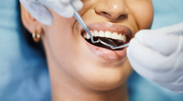 Best Emergency Broken Tooth Repair in Laureldale, PA